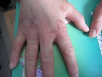 ���ݷ���Ƥ����ҽԺ