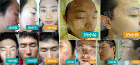 ���ݷ���Ƥ����ҽԺ