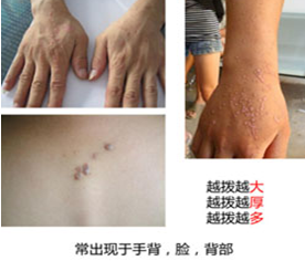 ���ݷ���Ƥ����ҽԺ