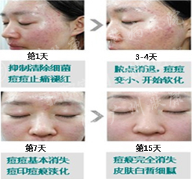 ���ݷ���Ƥ����ҽԺ