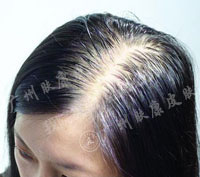 广州肤康皮肤病医院