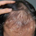 广州肤康皮肤病医院