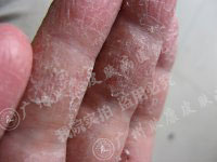 ���ݷ���Ƥ����ҽԺ