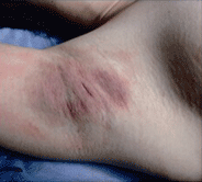 ���ݷ���Ƥ����ҽԺ