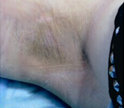 ���ݷ���Ƥ����ҽԺ