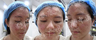 广州肤康皮肤病医院