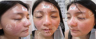 广州肤康皮肤病医院