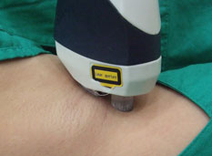 广州肤康皮肤病医院