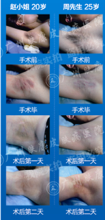 广州肤康皮肤病医院