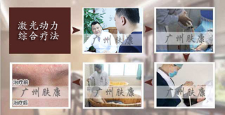 ���ݷ���Ƥ����ҽԺ