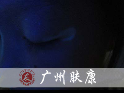 广州肤康皮肤病医院