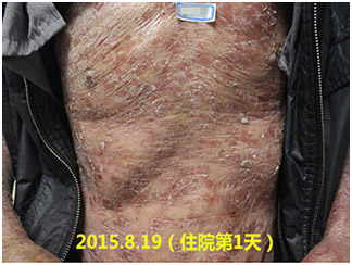 广州肤康皮肤病医院