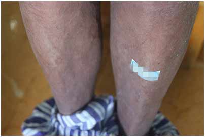 ���ݷ���Ƥ����ҽԺ