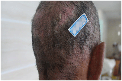 广州肤康皮肤病医院