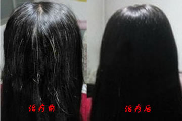 广州肤康皮肤病医院