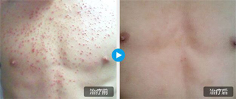 广州肤康皮肤病医院