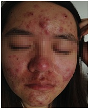 广州肤康皮肤病医院