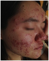 广州肤康皮肤病医院