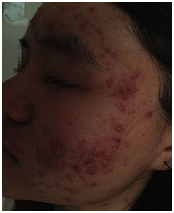 ���ݷ���Ƥ����ҽԺ