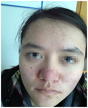 广州肤康皮肤病医院