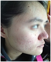 广州肤康皮肤病医院