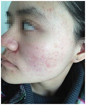 广州肤康皮肤病医院