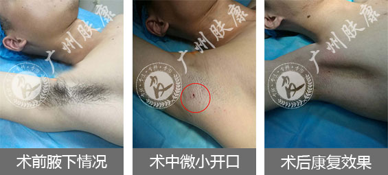 广州肤康皮肤病医院