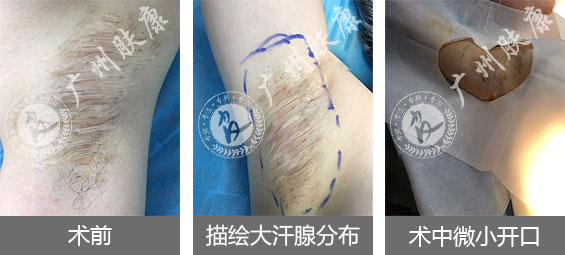 ���ݷ���Ƥ����ҽԺ