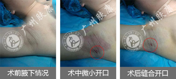 ���ݷ���Ƥ����ҽԺ