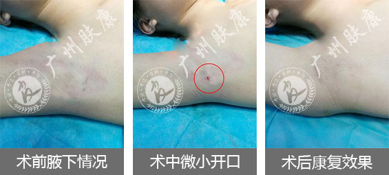 广州肤康皮肤病医院