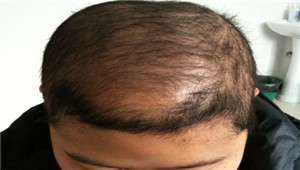 广州肤康皮肤病医院