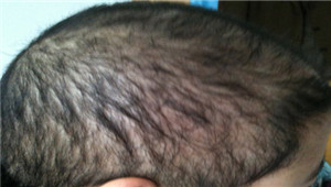 广州肤康皮肤病医院