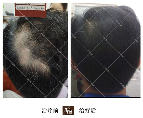 广州肤康皮肤病医院