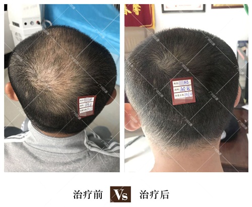 广州肤康皮肤病医院