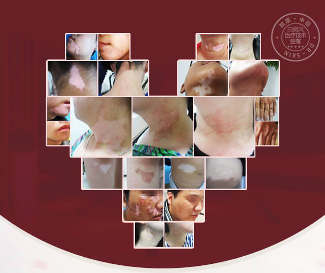 ���ݷ���Ƥ����ҽԺ