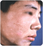 ���ݷ���Ƥ����ҽԺ