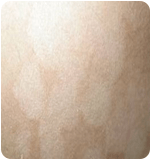 ���ݷ���Ƥ����ҽԺ