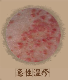 ���ݷ���Ƥ����ҽԺ