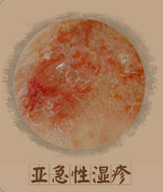 ���ݷ���Ƥ����ҽԺ