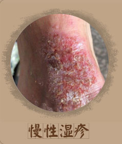 ���ݷ���Ƥ����ҽԺ