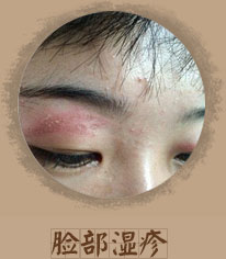 ���ݷ���Ƥ����ҽԺ