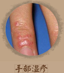 ���ݷ���Ƥ����ҽԺ