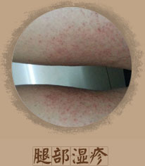 ���ݷ���Ƥ����ҽԺ