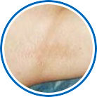 ���ݷ���Ƥ����ҽԺ