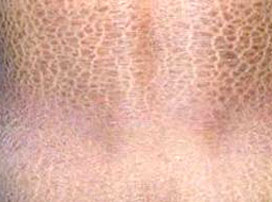ݷƤҽԺ
